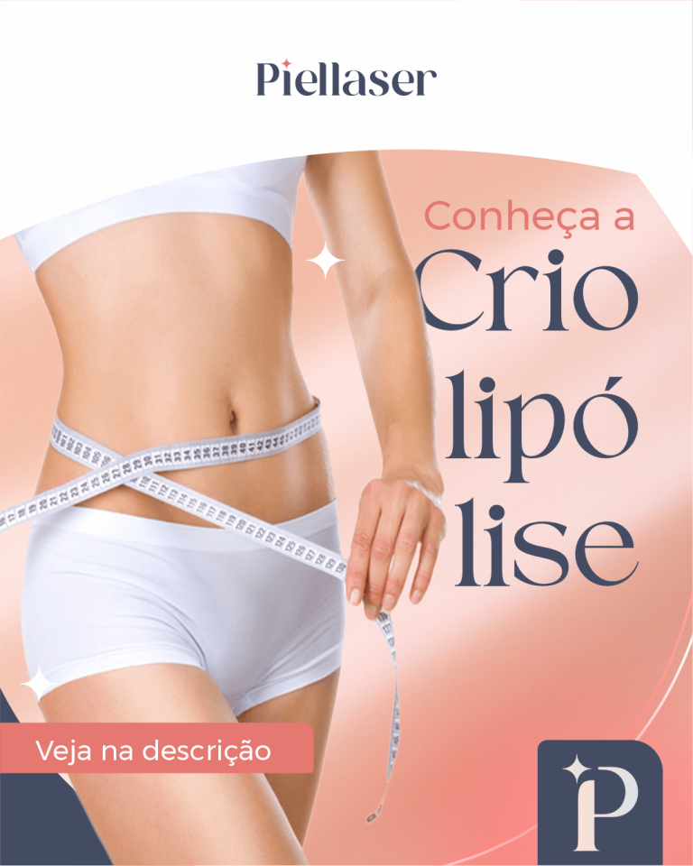 Leia mais sobre o artigo Você já conhece a criolipólise e seus benefícios?