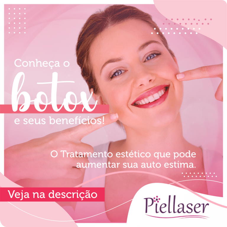 Leia mais sobre o artigo Conheça o Botox e seus benefícios