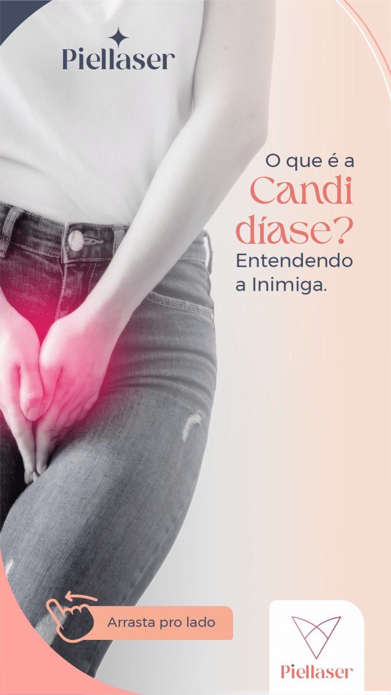 Leia mais sobre o artigo Candidiase: Causas, tratamentos e como evitar