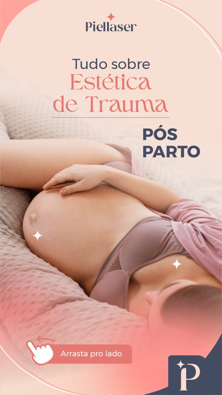 Leia mais sobre o artigo Tudo sobre Estética de Trauma pos parto